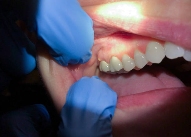 Best Emergency TMJ Treatment in Dayton, WA
