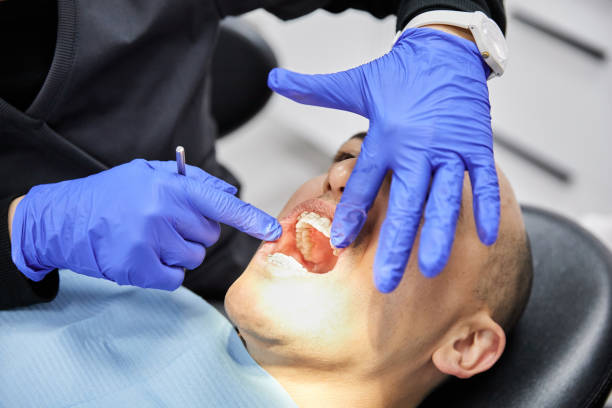 Best Emergency Tooth Extraction in Dayton, WA